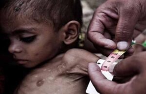 सरकार की गंभीरता पर उठे सवाल, महंगाई के दौर में बच्चों के पोषण के लिए सिर्फ 8 रुपए!