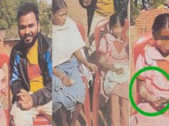 दुर्लभ बीमारी से पीड़ित बच्ची के उपचार के लिए बाल आयोग हरकत में, प्रशासन से मांगी रिपोर्ट
