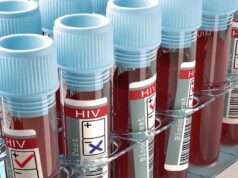 HIV को लेकर मध्यप्रदेश में बढ़ी चिंता, जांच में कमी और बढ़ते मामलों ने बढ़ाई चुनौती
