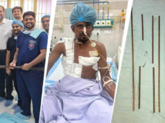 4 लोहे के सरियों के साथ अस्पताल पहुंचा मजदूर, KGMU में साढ़े आठ घंटे चली सर्जरी बनी नई जिंदगी की उम्मीद