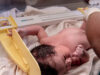 क्या ब्लड टेस्ट से बच्चों में बढ़ रहा बीमारी का खतरा? NICU पर नई स्टडी ने बढ़ाई चिंता