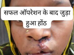 स्वास्थ्य सेवाओं की सफलता, सफल ऑपरेशन के बाद भीमे हेमला फिर मुस्कुराए